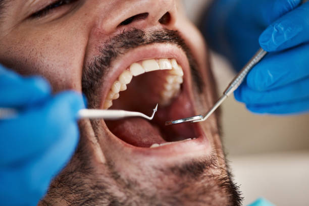 Best Dental Fillings (Composite and Amalgam)  in Terre Haute, IN